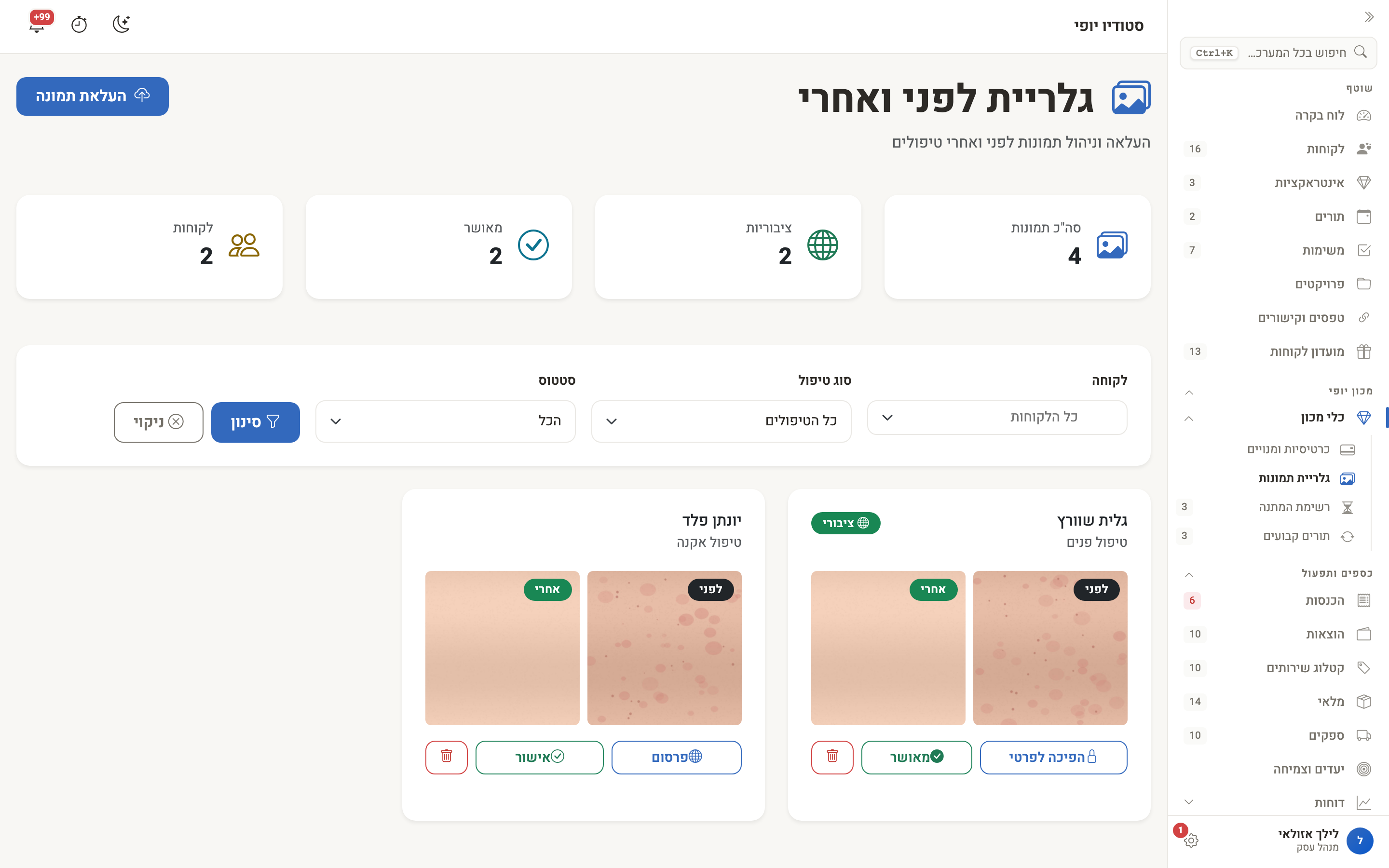 גלריית לפני ואחרי — זוגות תמונות לפי לקוחה וטיפול