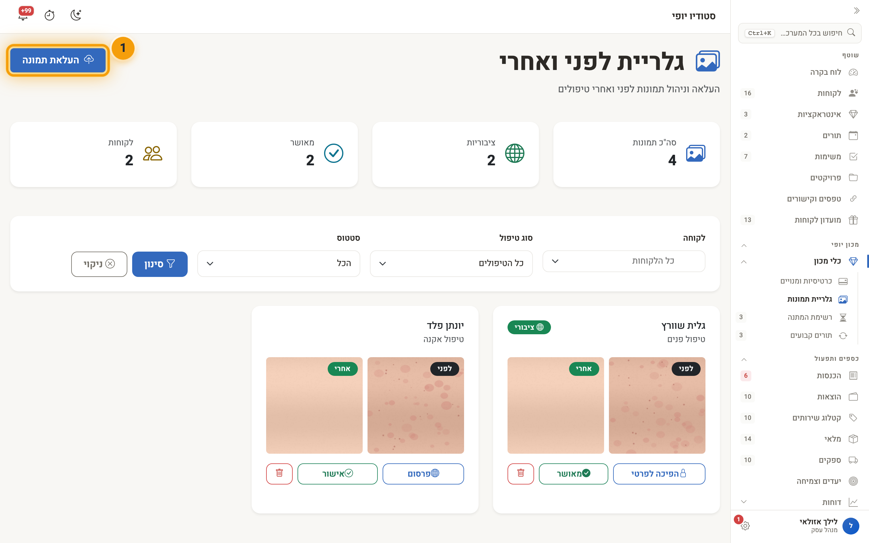 כפתור ״העלאת תמונה״ בגלריה